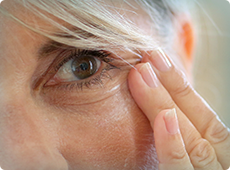 woman-with-eye-wrinkles-ben-001 woman-with-eye-wrinkles-ben-001