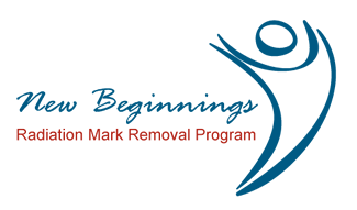 new beginnings radiation mark removal program new beginnings radiation mark removal program