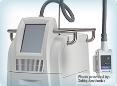 devices-cryolipolysis-ben-001