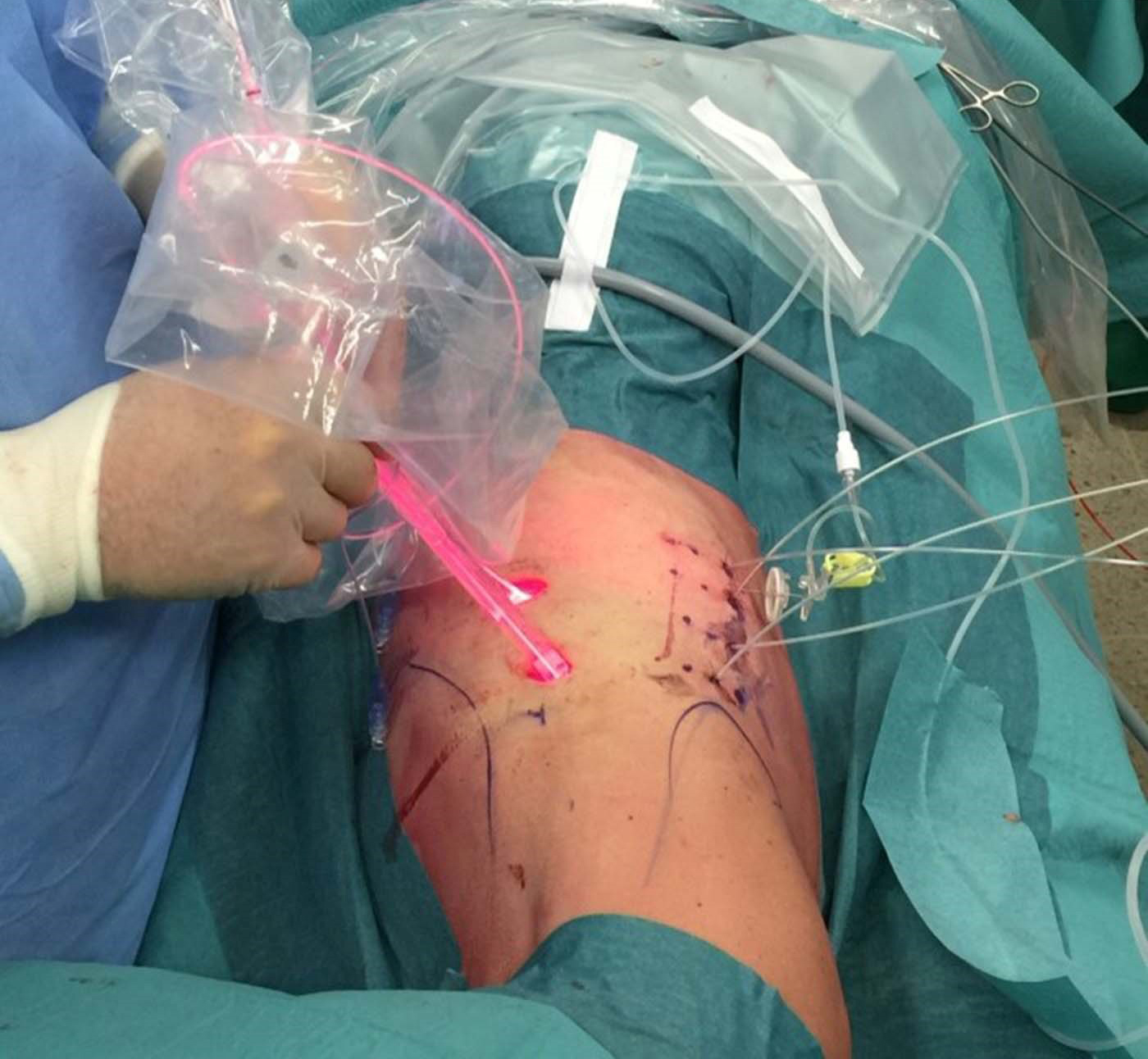 LSM-18-0200.R1 - EC - Perentes-cropped