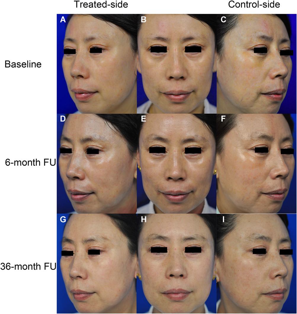 lsm23393-fig-0003-m (2)