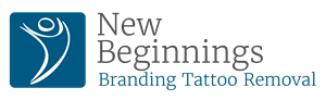 nb-branding-tattoo-removal-logo nb-branding-tattoo-removal-logo