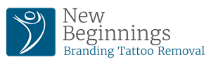 nb-branding-tattoo-removal-logo